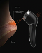 11_medical_callus_anatomy.png