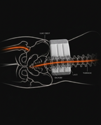 11_medical_hip_spine_chain.png