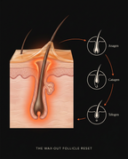 12_medical_follicle_anatomy.png